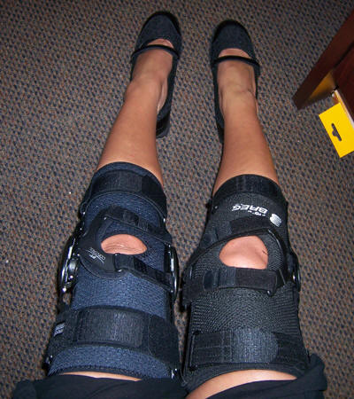 Knee braces